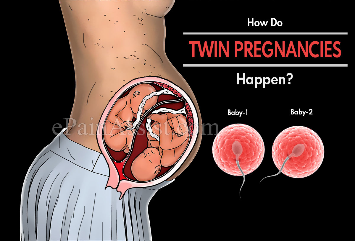 How Do Twin Pregnancies Happen?