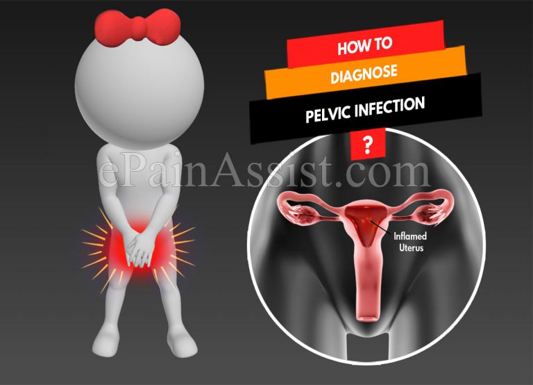 How To Diagnose Pelvic Infection & What Is The Best Medicine For It?