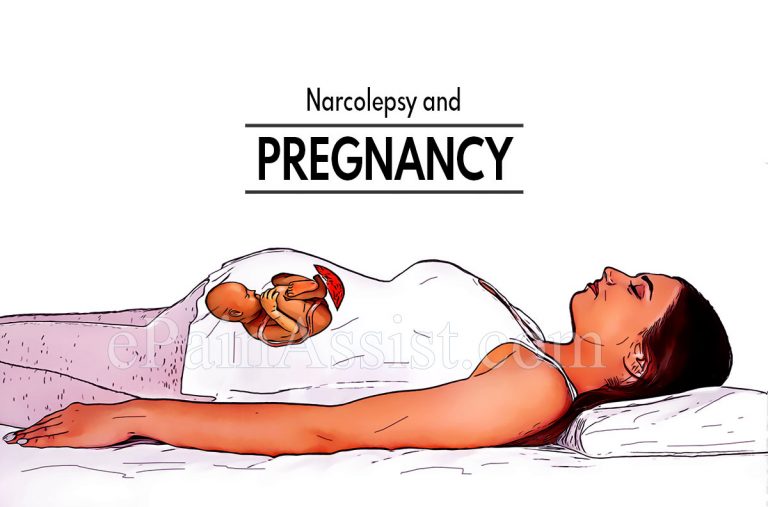 Narcolepsy and Pregnancy