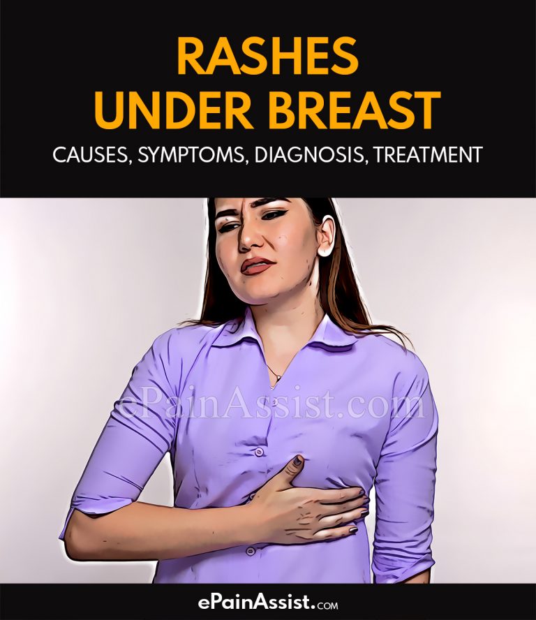 Rashes Under Breast: Causes, Symptoms, Diagnosis, Treatment
