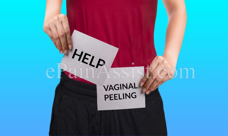 What is Vaginal Skin Peeling?