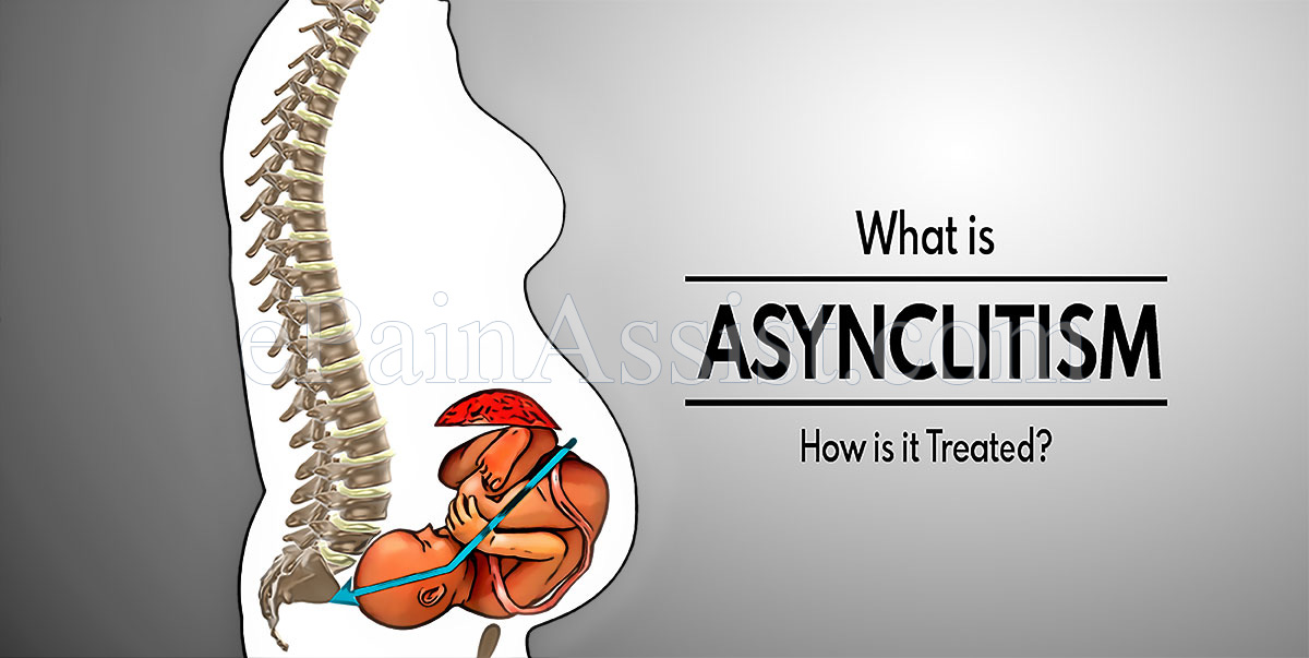 How is Asynclitism Diagnosed?