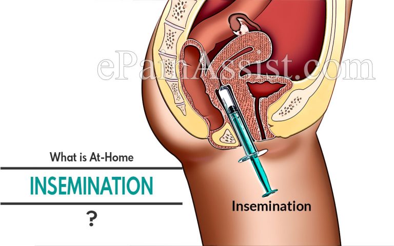 What is At-Home Insemination?