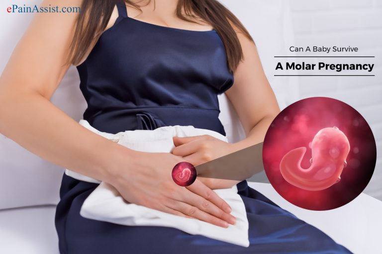 Can A Baby Survive A Molar Pregnancy?
