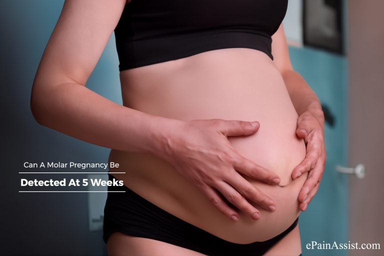 Can A Molar Pregnancy Be Detected At 5 Weeks?