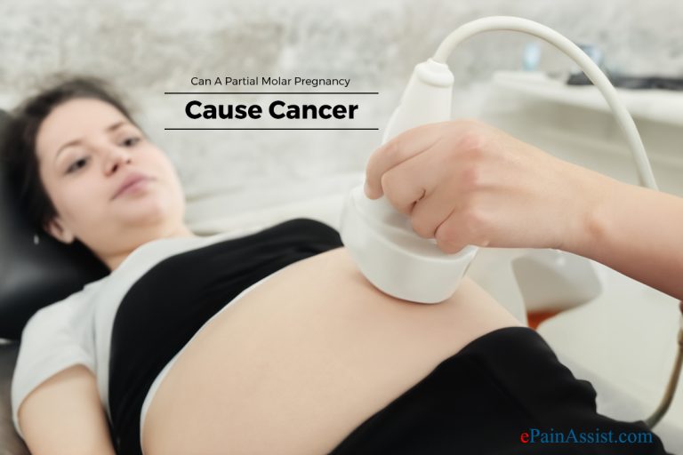 Can A Partial Molar Pregnancy Cause Cancer?