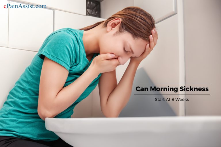 Can Morning Sickness Start At 8 Weeks?