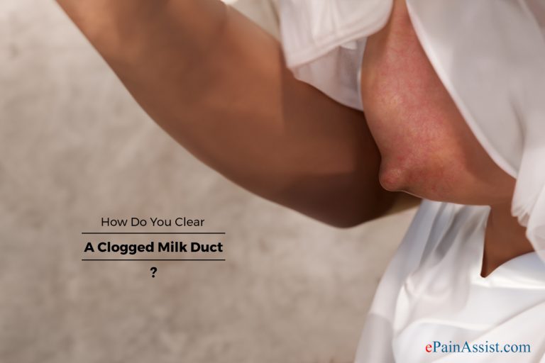 How Do You Clear A Clogged Milk Duct?