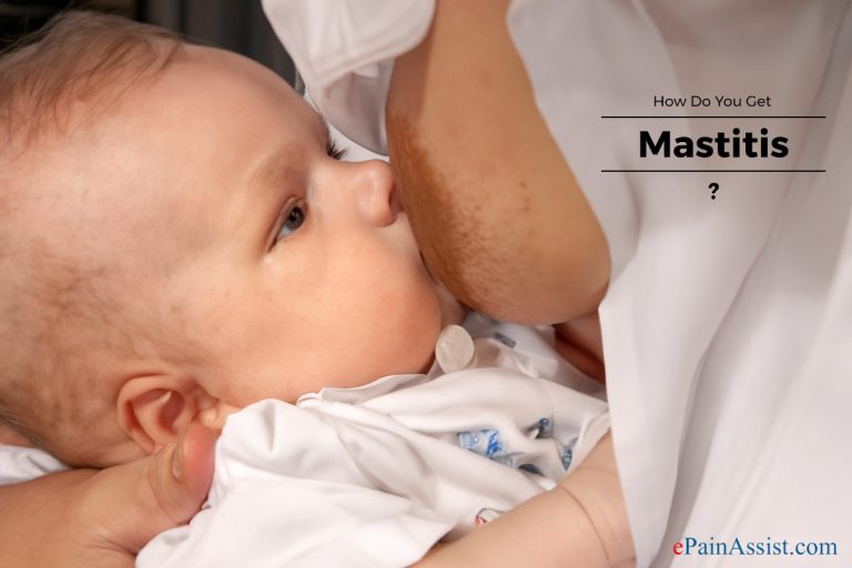 How Do You Get Mastitis?