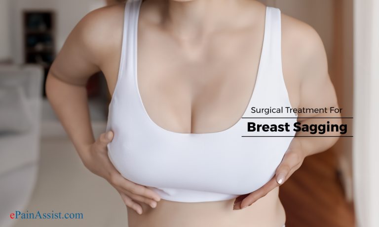 Surgical Treatments & Exercises for Breast Sagging