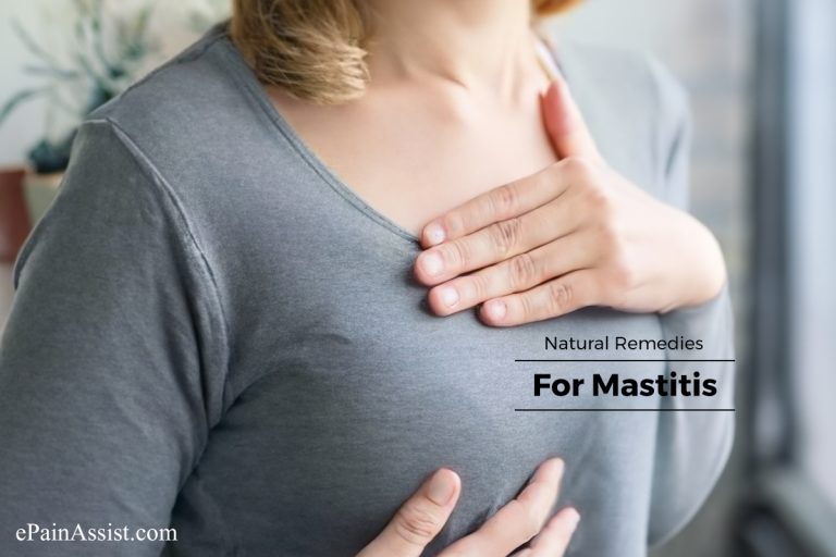 What Are The Natural Remedies For Mastitis?