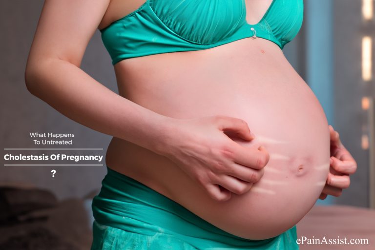 What Happens To Untreated Cholestasis Of Pregnancy & When To Go To Doctor?