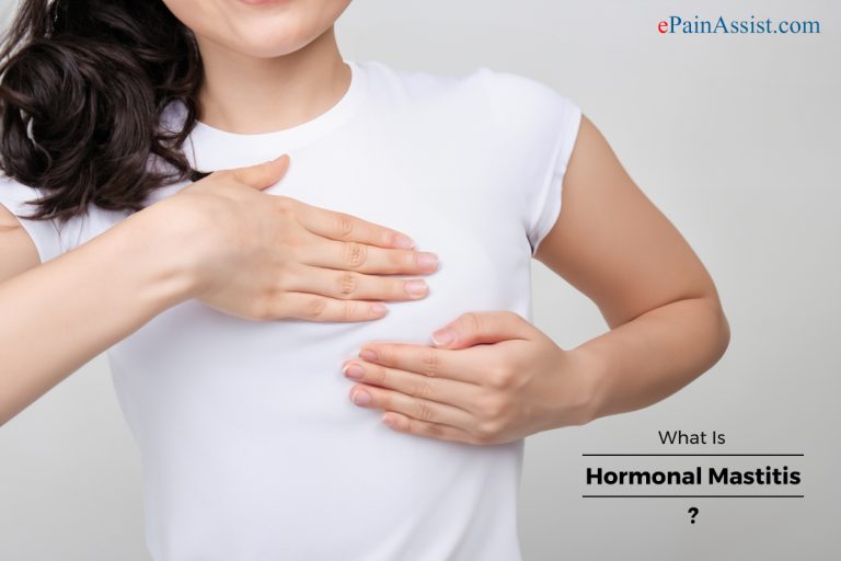 What Is Hormonal Mastitis?