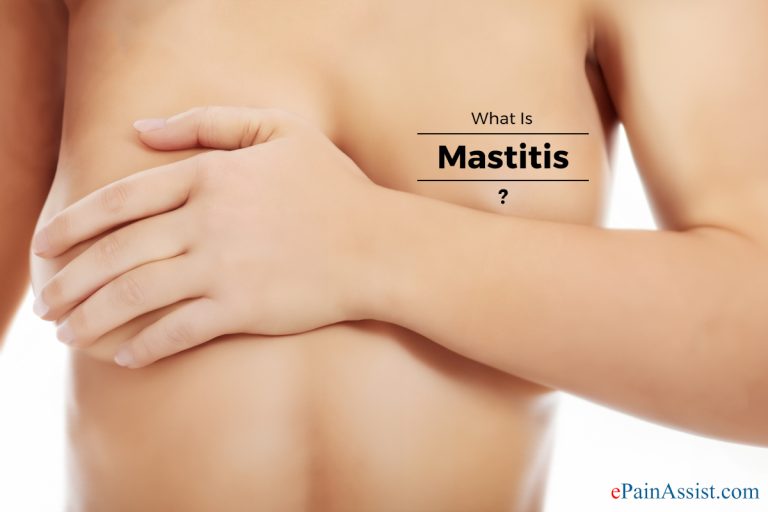 What To Do If You Think You Have Mastitis?