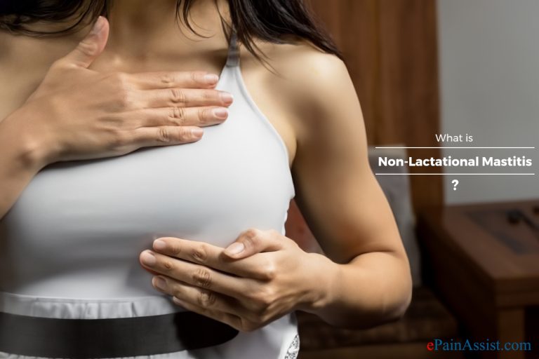 What Is Non-Lactational Mastitis?