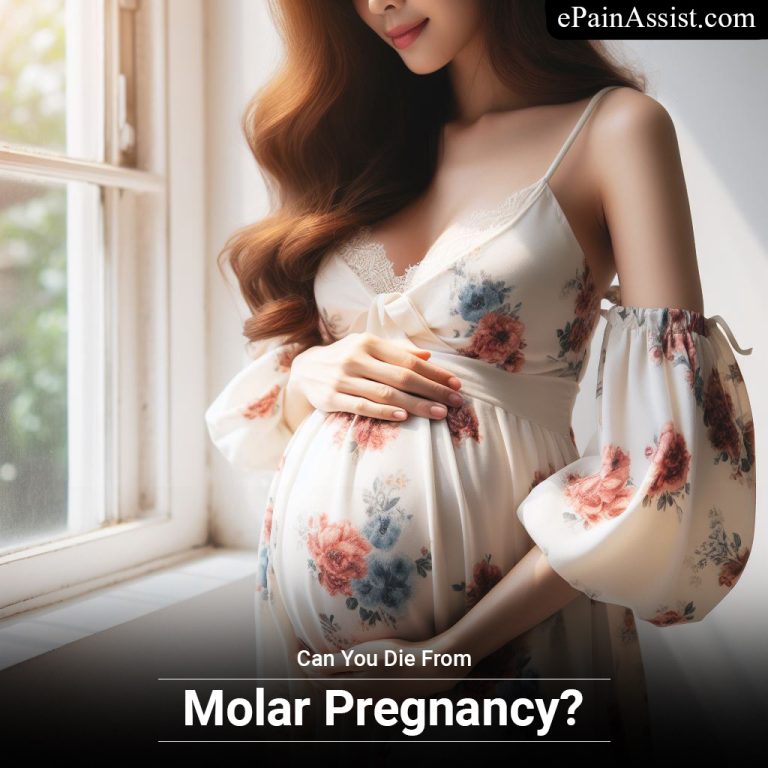 Can You Die From Molar Pregnancy?
