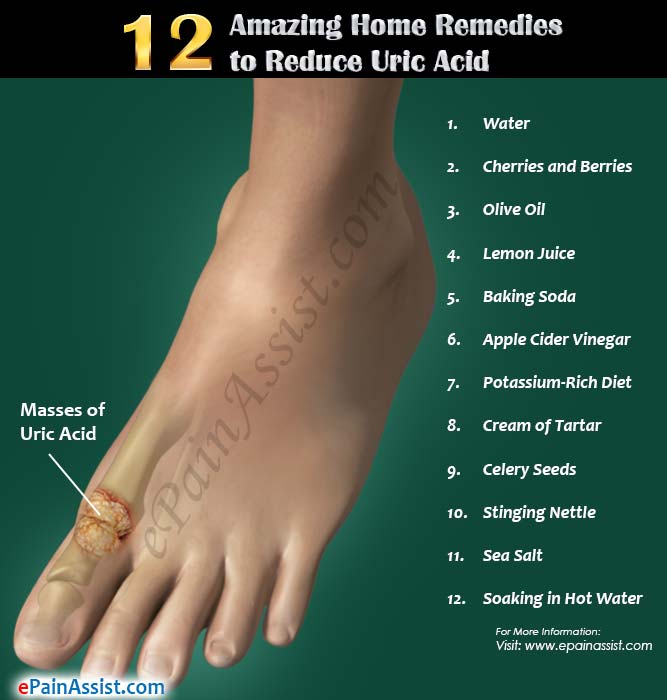 12 Amazing Home Remedies to Reduce Uric Acid