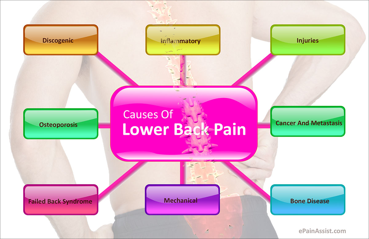 Causes of Lower Back Pain in Older Patients