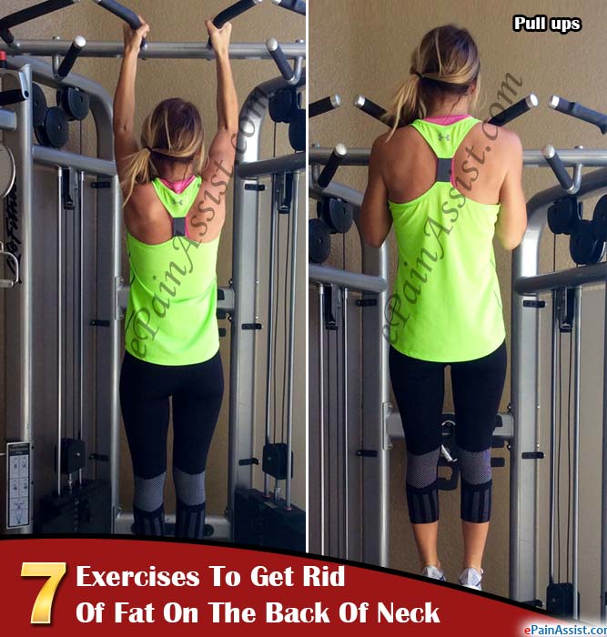 7 Exercises to Get Rid of Fat on the Back of Neck