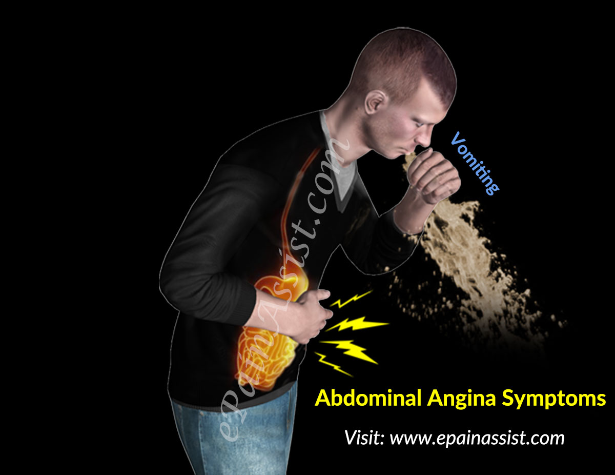 Abdominal Angina Symptoms Abdominal Angina Symptoms