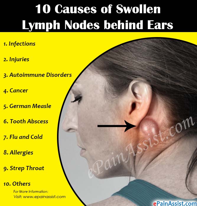 10 Causes of Swollen Lymph Nodes behind Ears