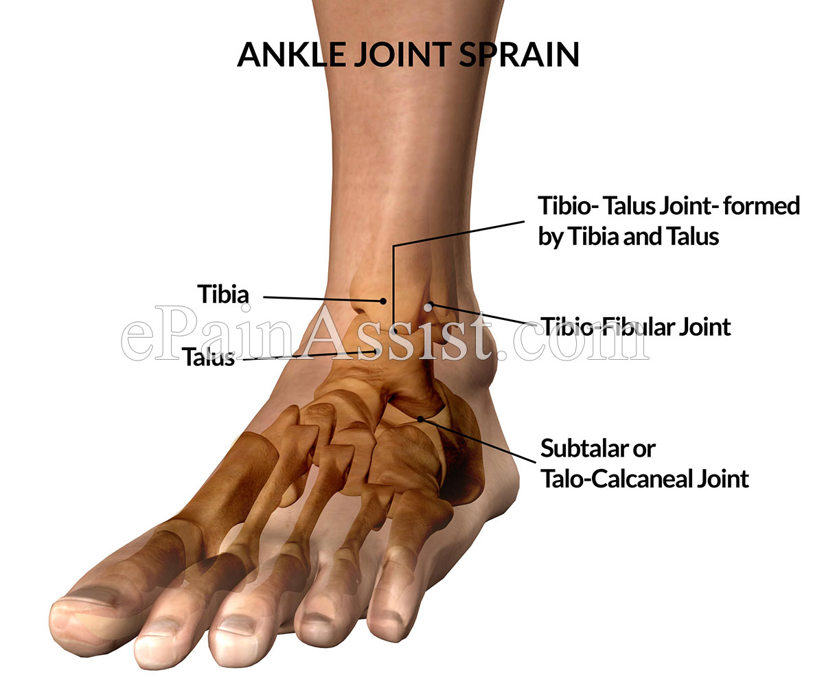 Ankle Joint SprainCausesTypesSymptomsTreatment Conservative Ankle Joint SprainCausesTypesSymptomsTreatment Conservative