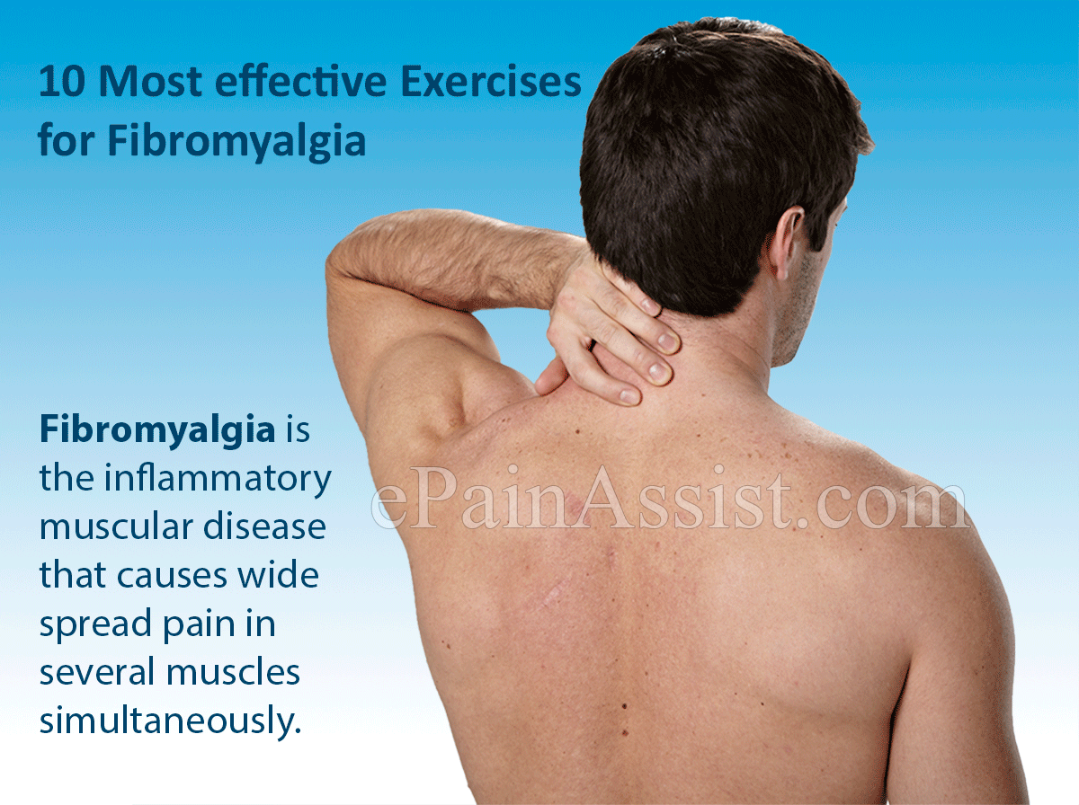 10 Best Exercises for Fibromyalgia 10 Best Exercises for Fibromyalgia
