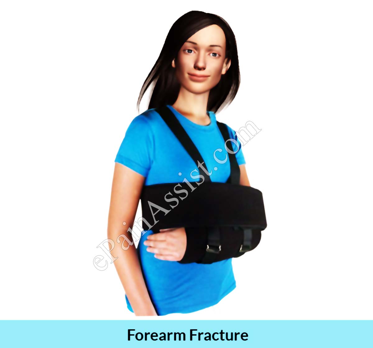 In case of a fracture, The arm should be kept in a sling to immobilize it. In case of a fracture,The arm should be kept in a sling to immobilize it.
