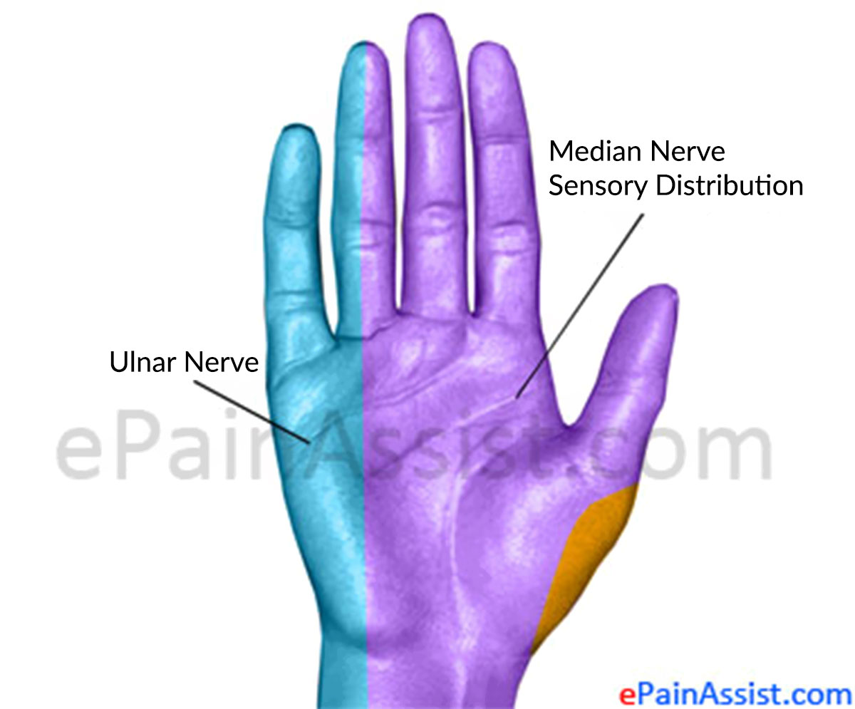 Median Nerve Injury Median Nerve Injury