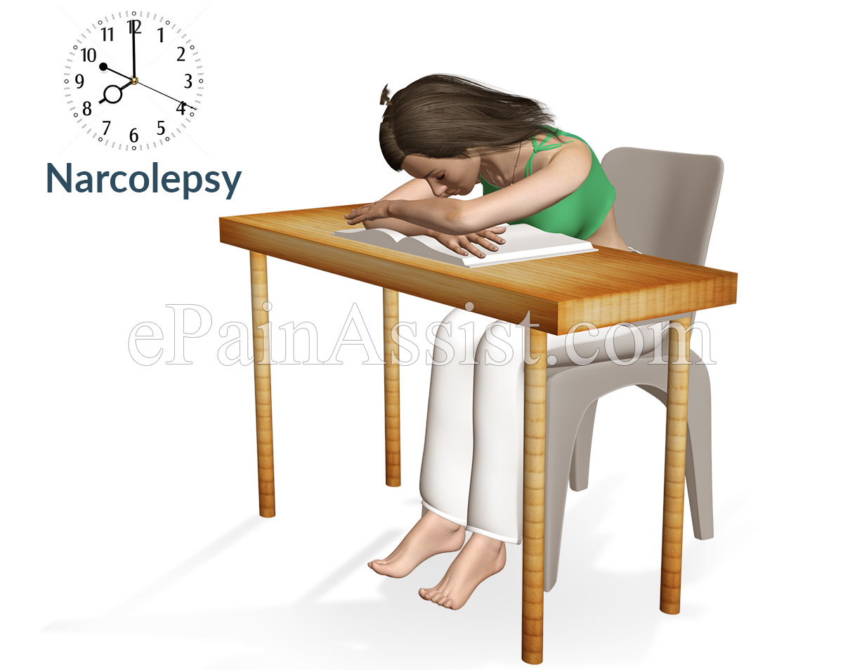 Narcolepsy Narcolepsy