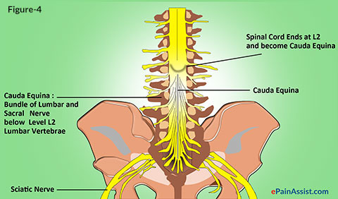 Caudal steroid injection results