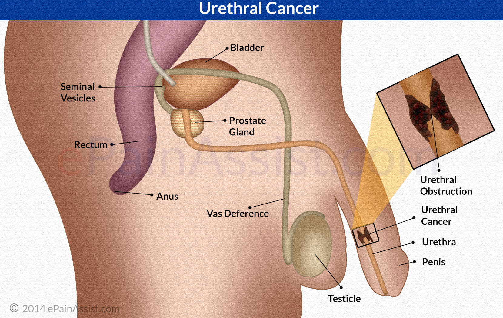 Penis In Urethra 91