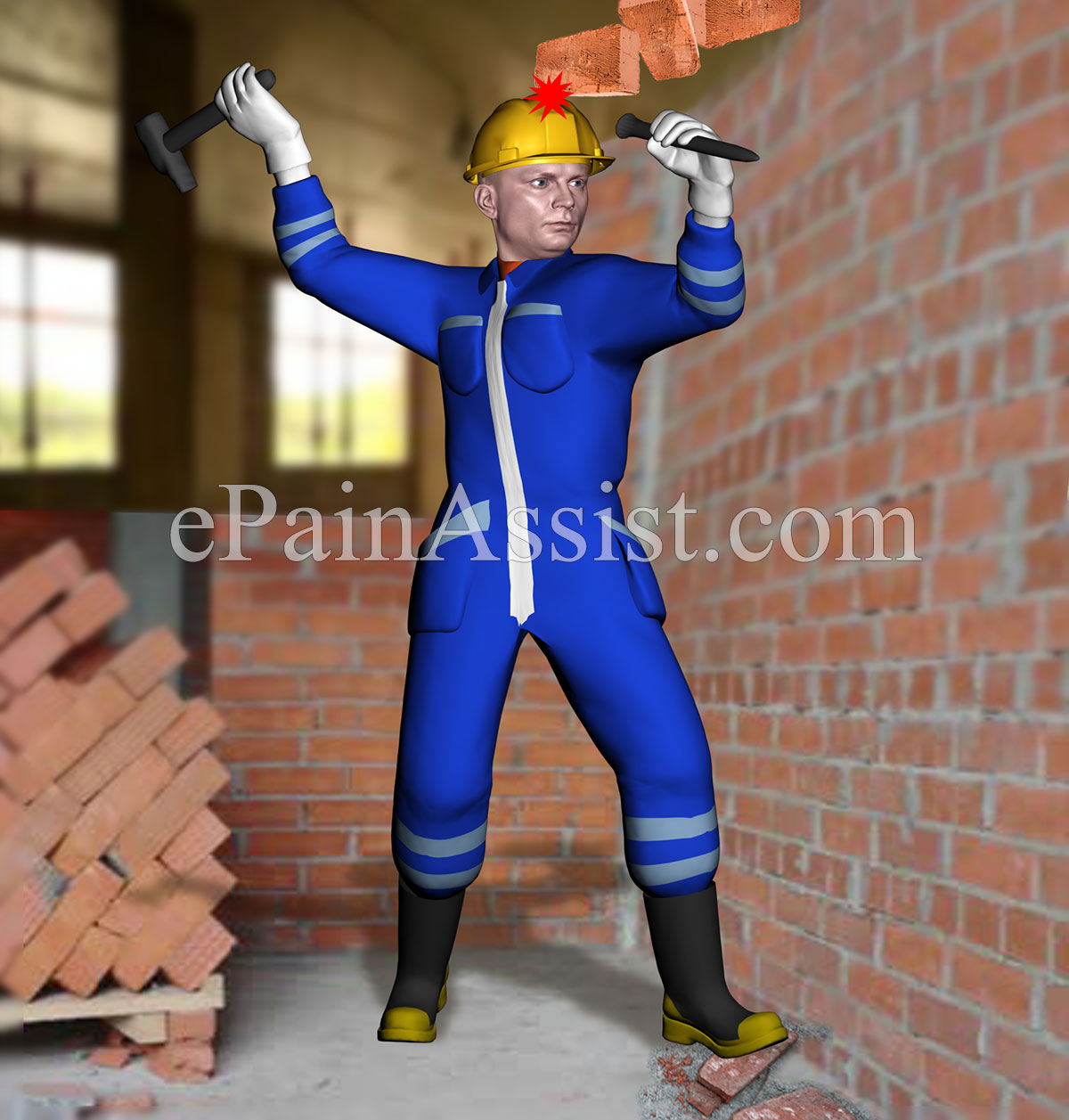 Workplace accidents or occupational accidents