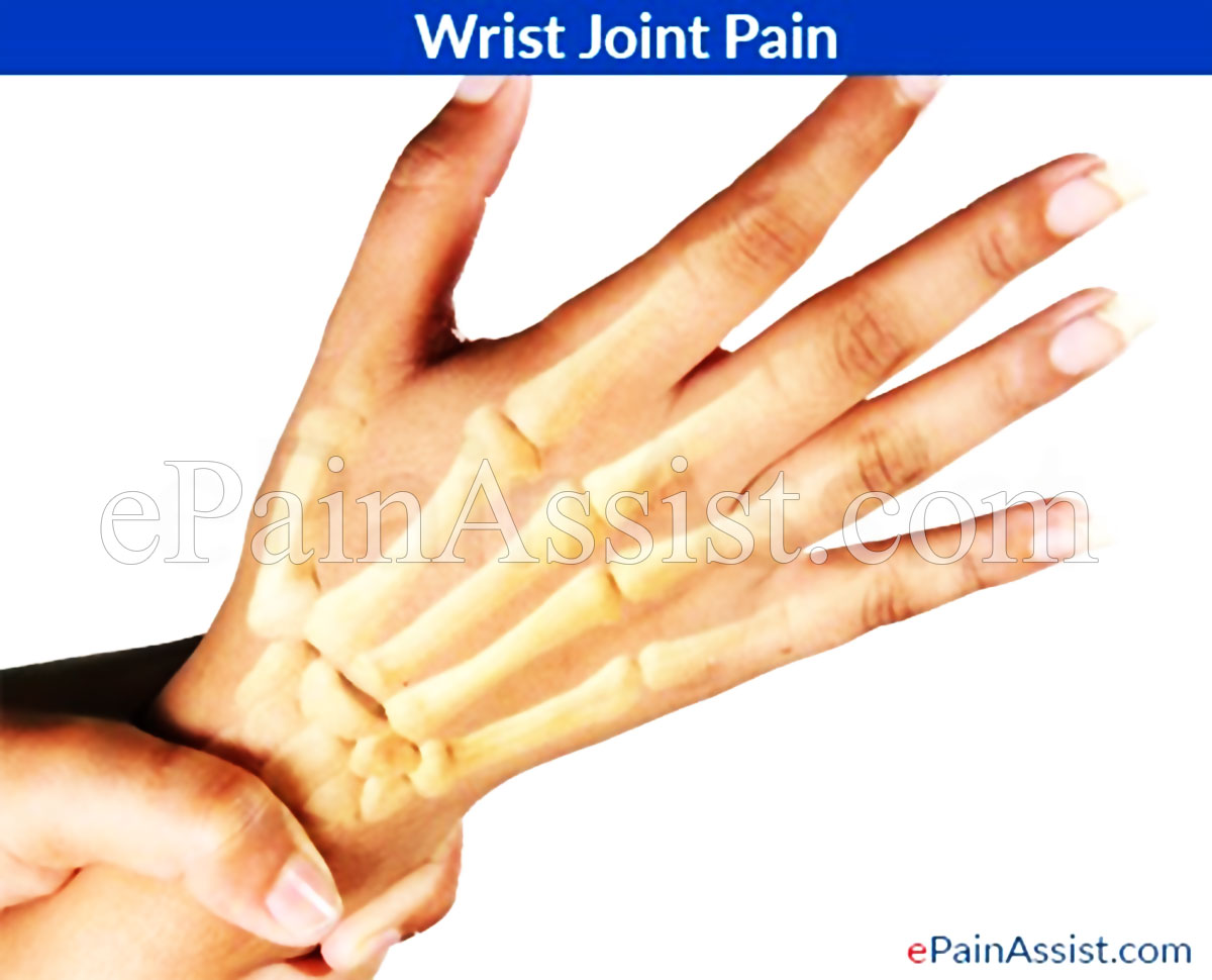 Wrist Joint Pain Wrist Joint Pain