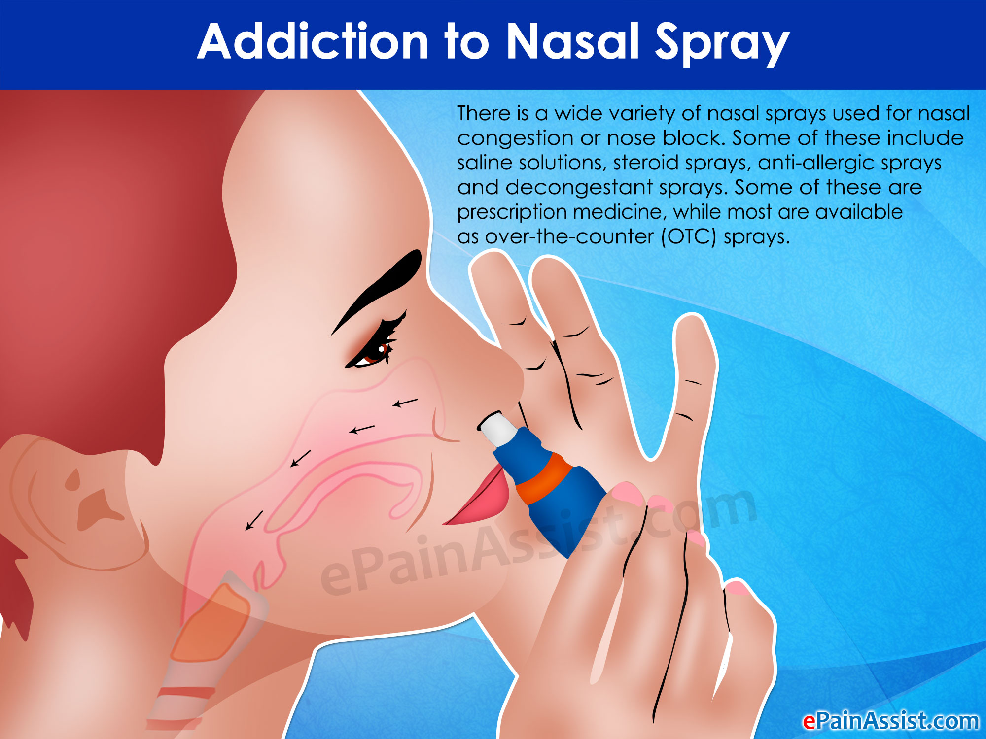 Addiction to Nasal Spray