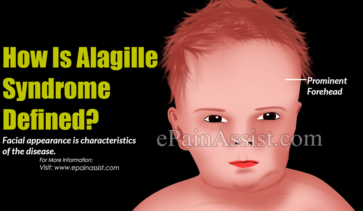 Alagille Syndrome Alagille Syndrome