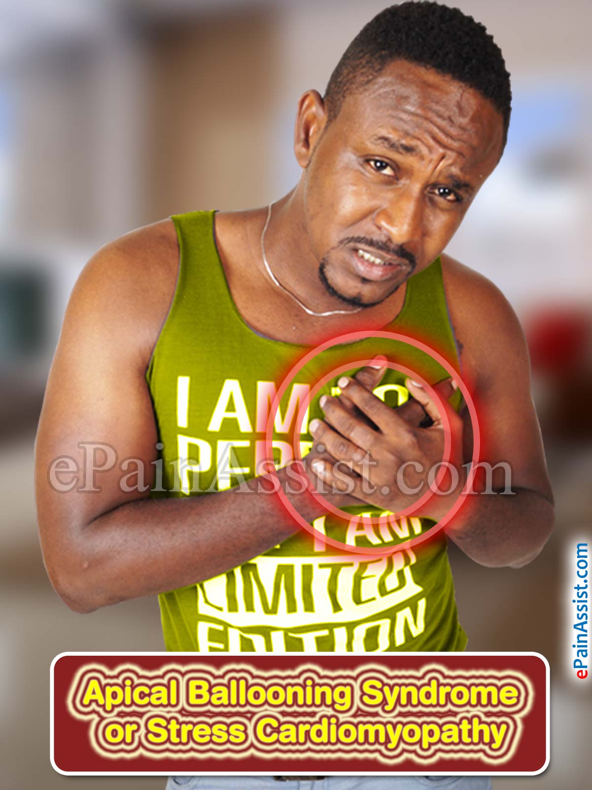 Apical Ballooning Syndrome or Stress Cardiomyopathy Apical Ballooning Syndrome or Stress Cardiomyopathy