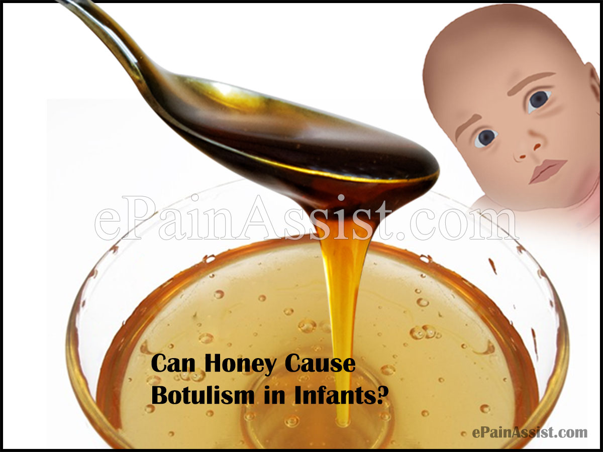 Can Honey Cause Botulism in Infants Can Honey Cause Botulism in Infants