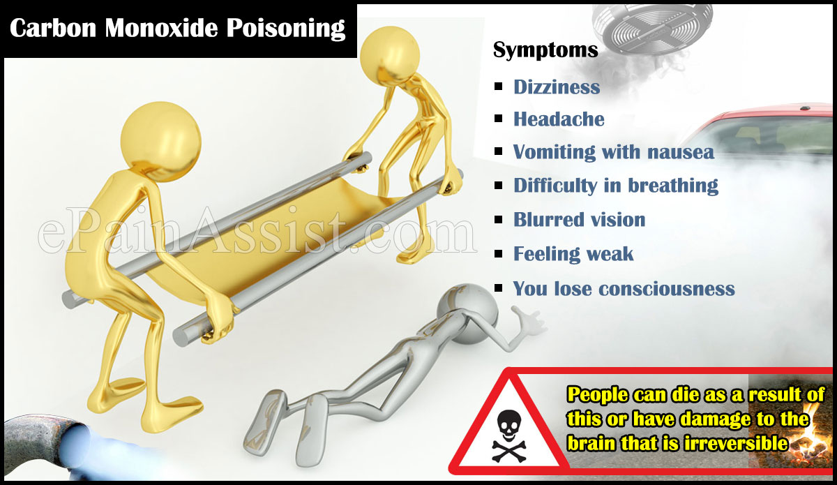 Carbon Monoxide Poisoning Carbon Monoxide Poisoning
