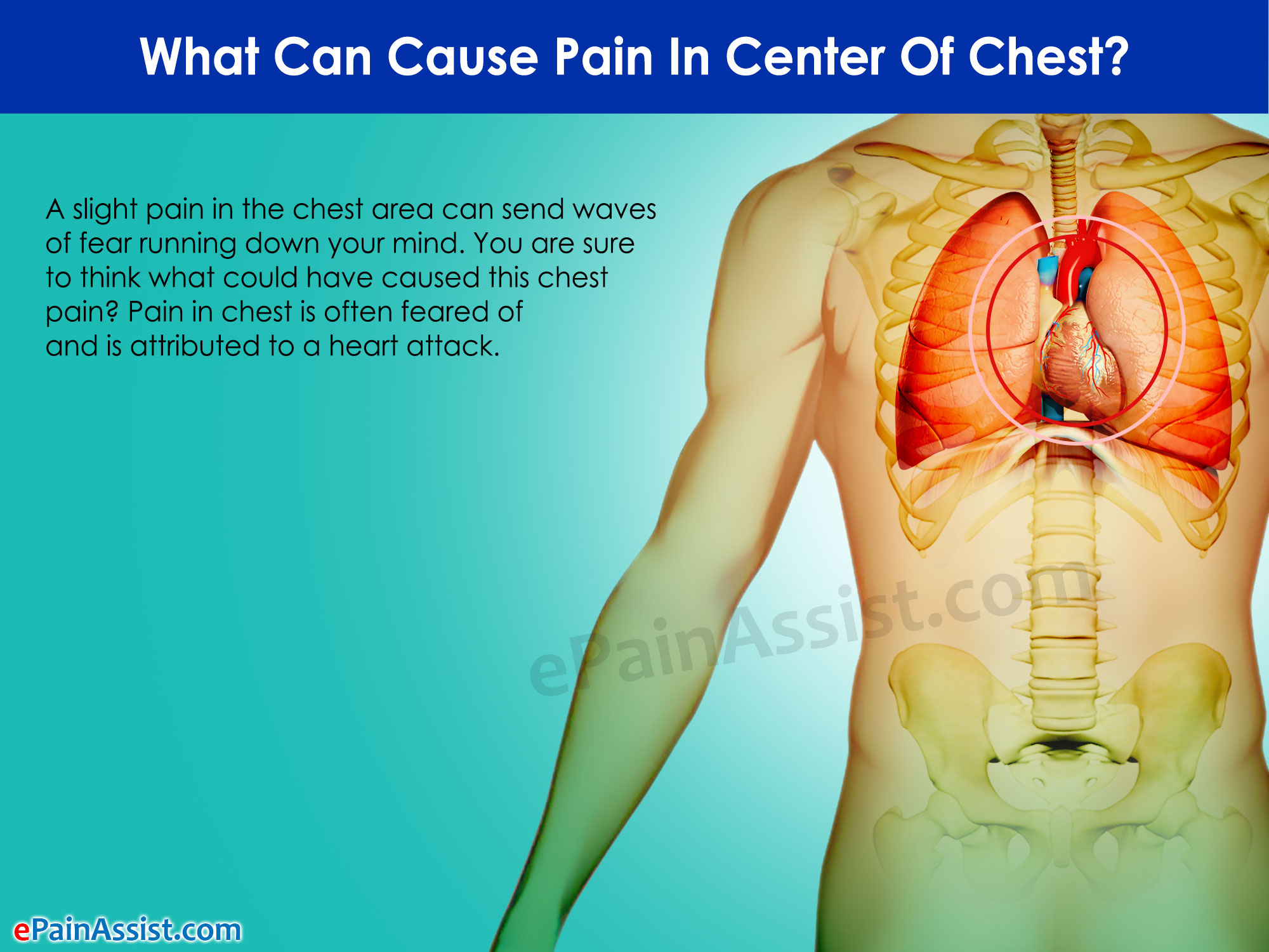 What Can Cause Pain In Center Of Chest