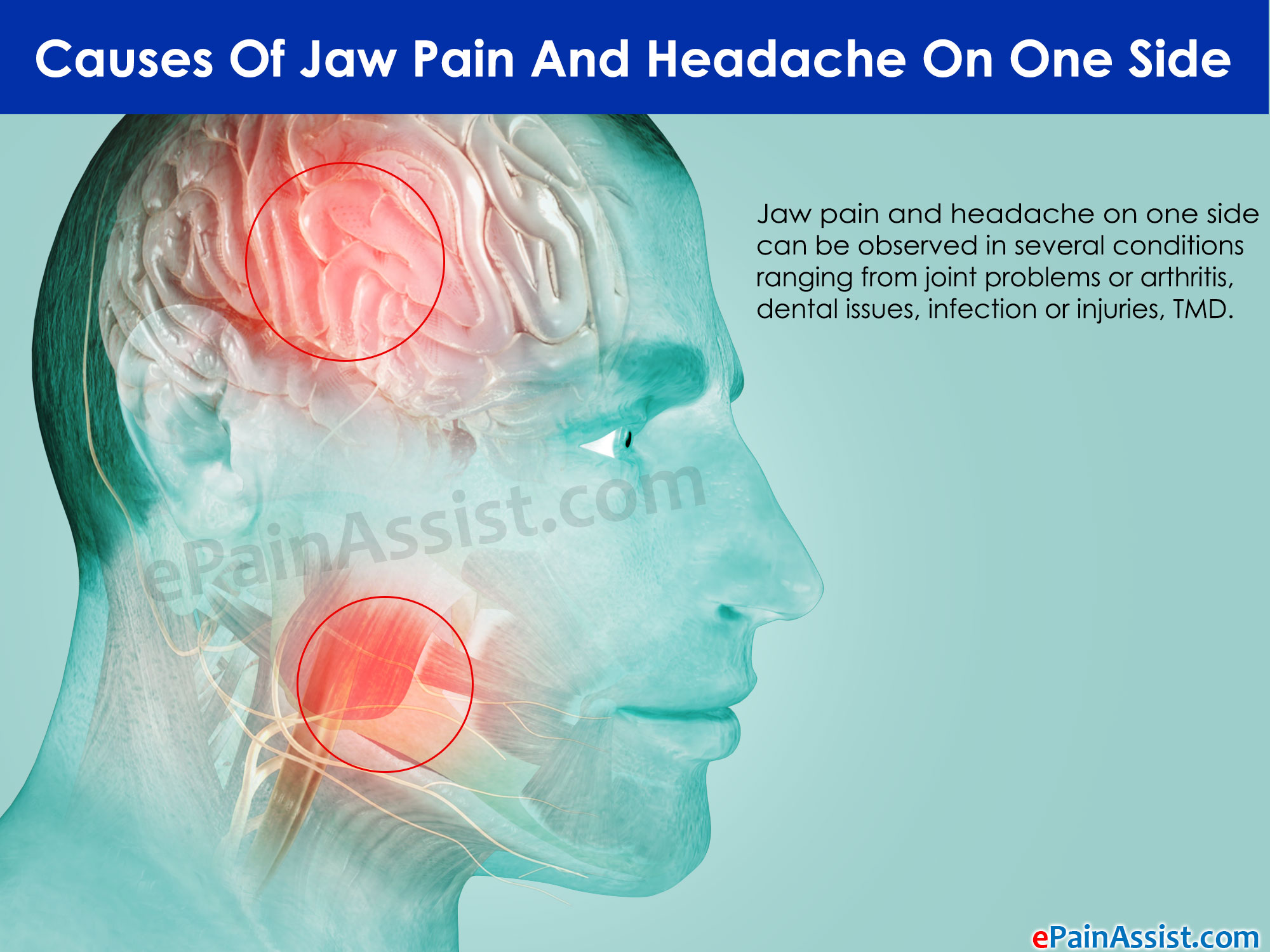 can sinus infection cause neck pain #11