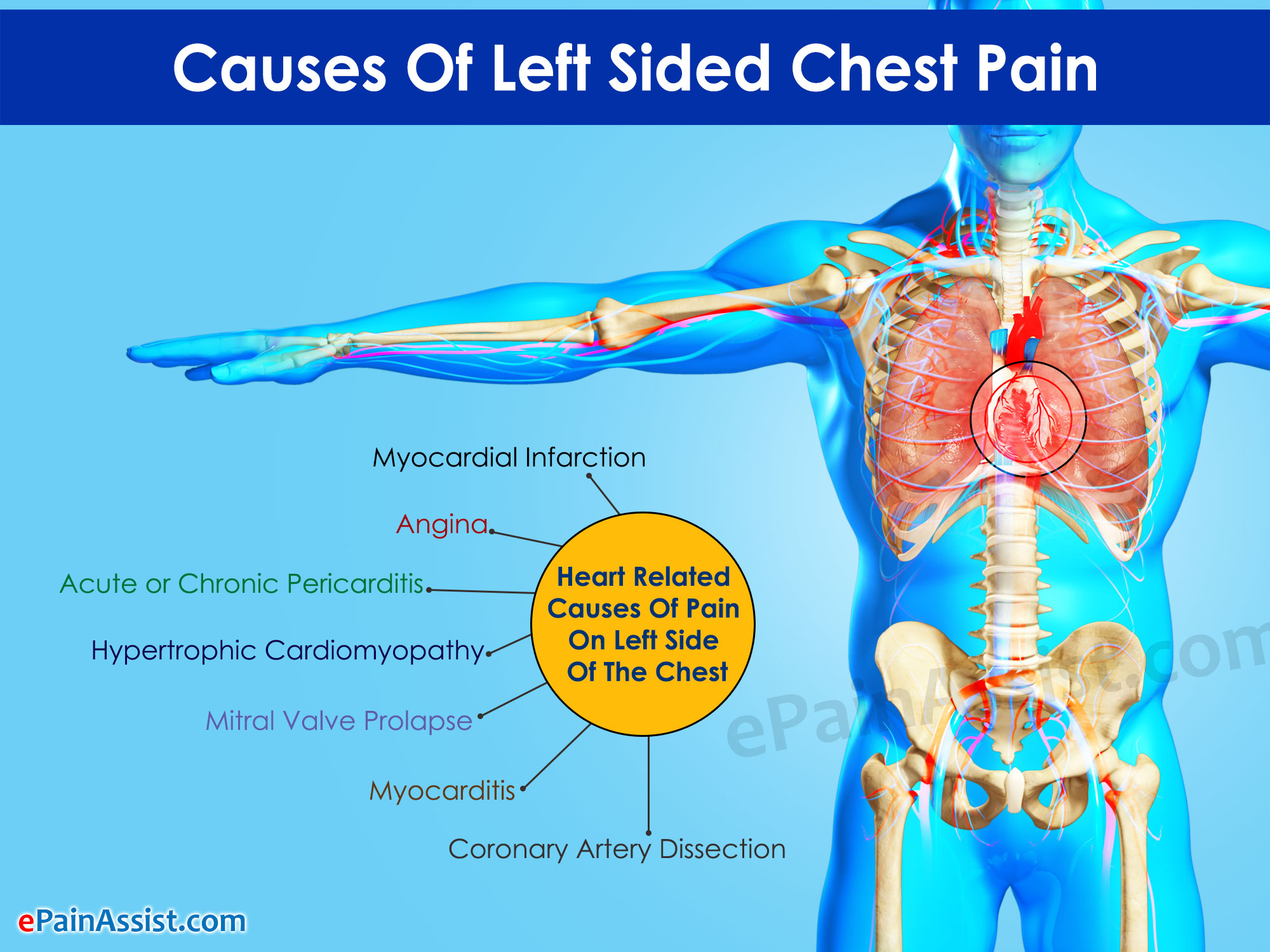 Causes Of Left Sided Chest Pain