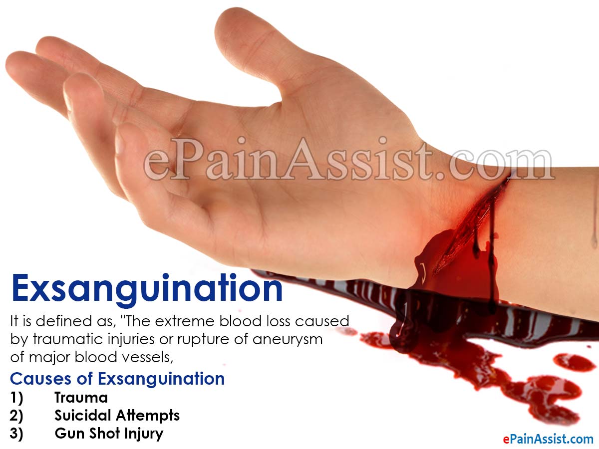 Causes of Exsanguination Causes of Exsanguination