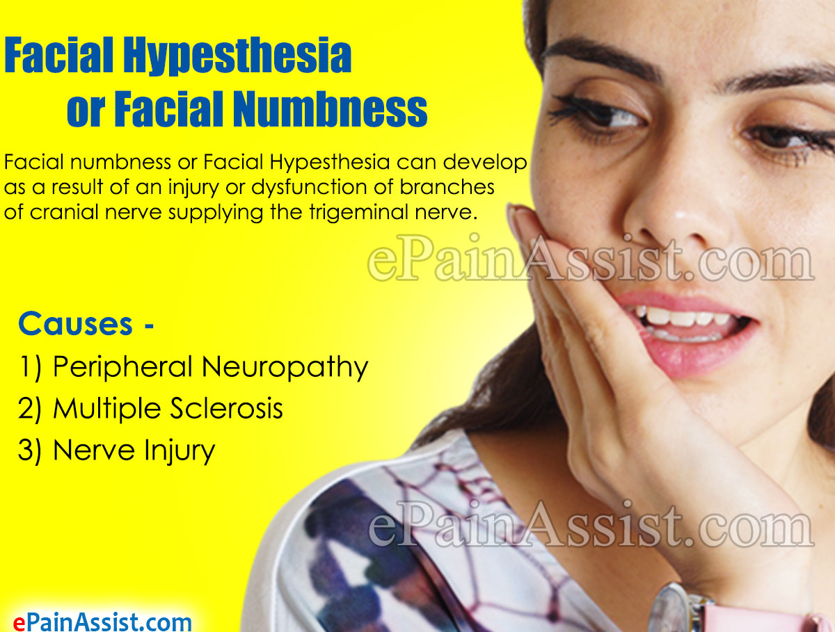 Facial Hypesthesia or Facial Numbness Facial Hypesthesia or Facial Numbness