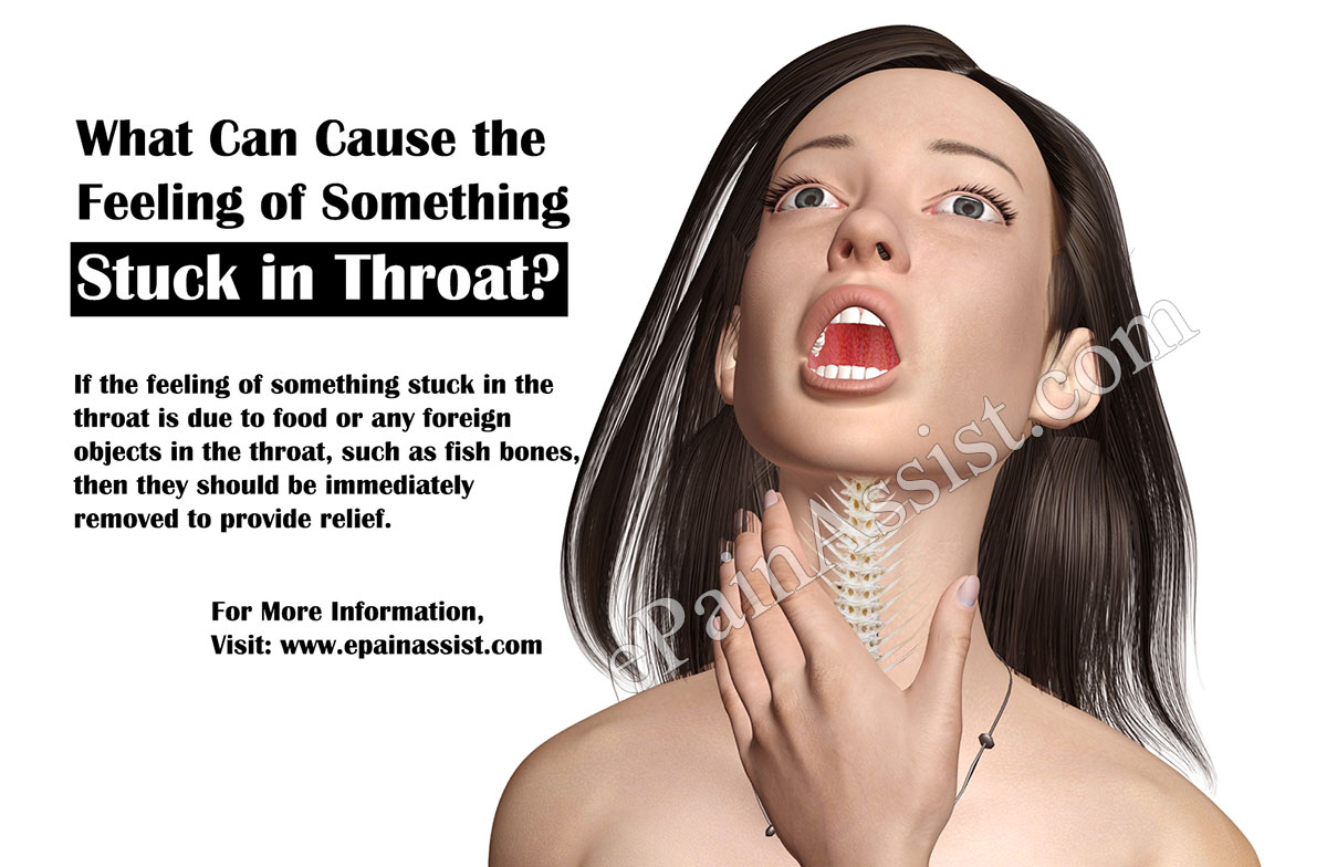 What Can Cause The Feeling Of Something Stuck In Throat What Can Cause The Feeling Of Something Stuck In Throat