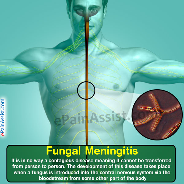 Fungal Meningitis