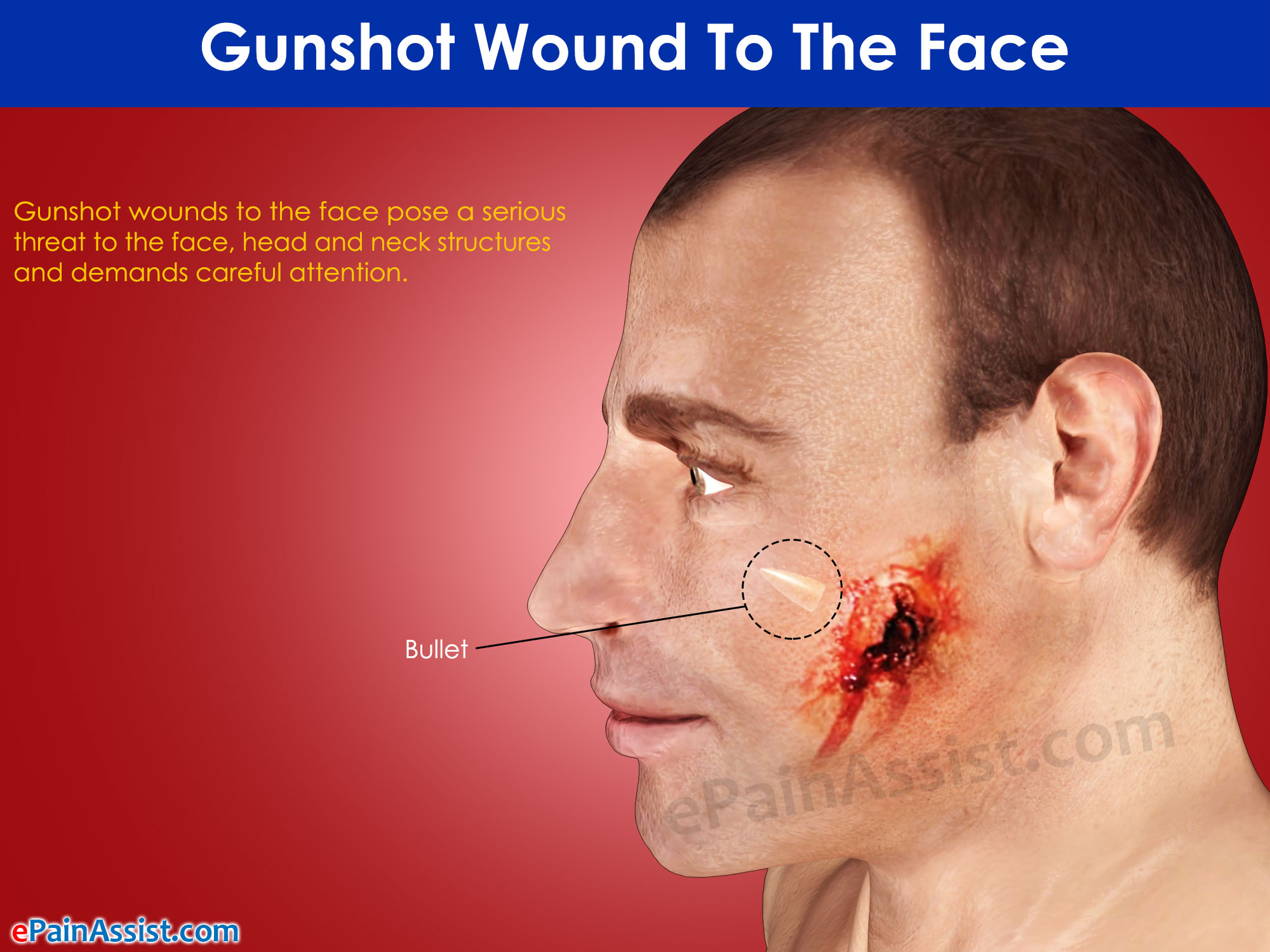 Healing Facial Wounds 102