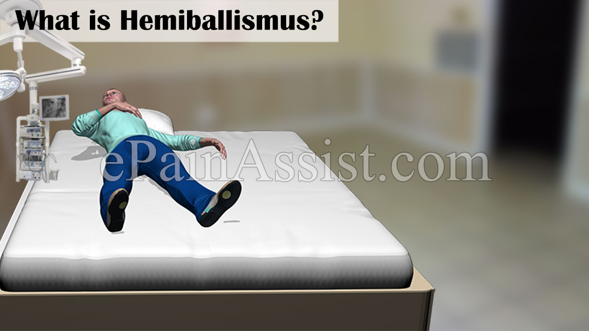 Hemiballismus Hemiballismus
