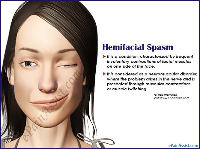 Facial Muscle Spasm 60