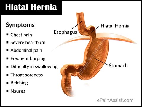 What are the risks of a hiatal hernia surgery?